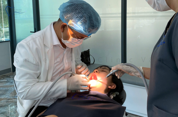 CẠO VÔI + ĐÁNH BÓNG